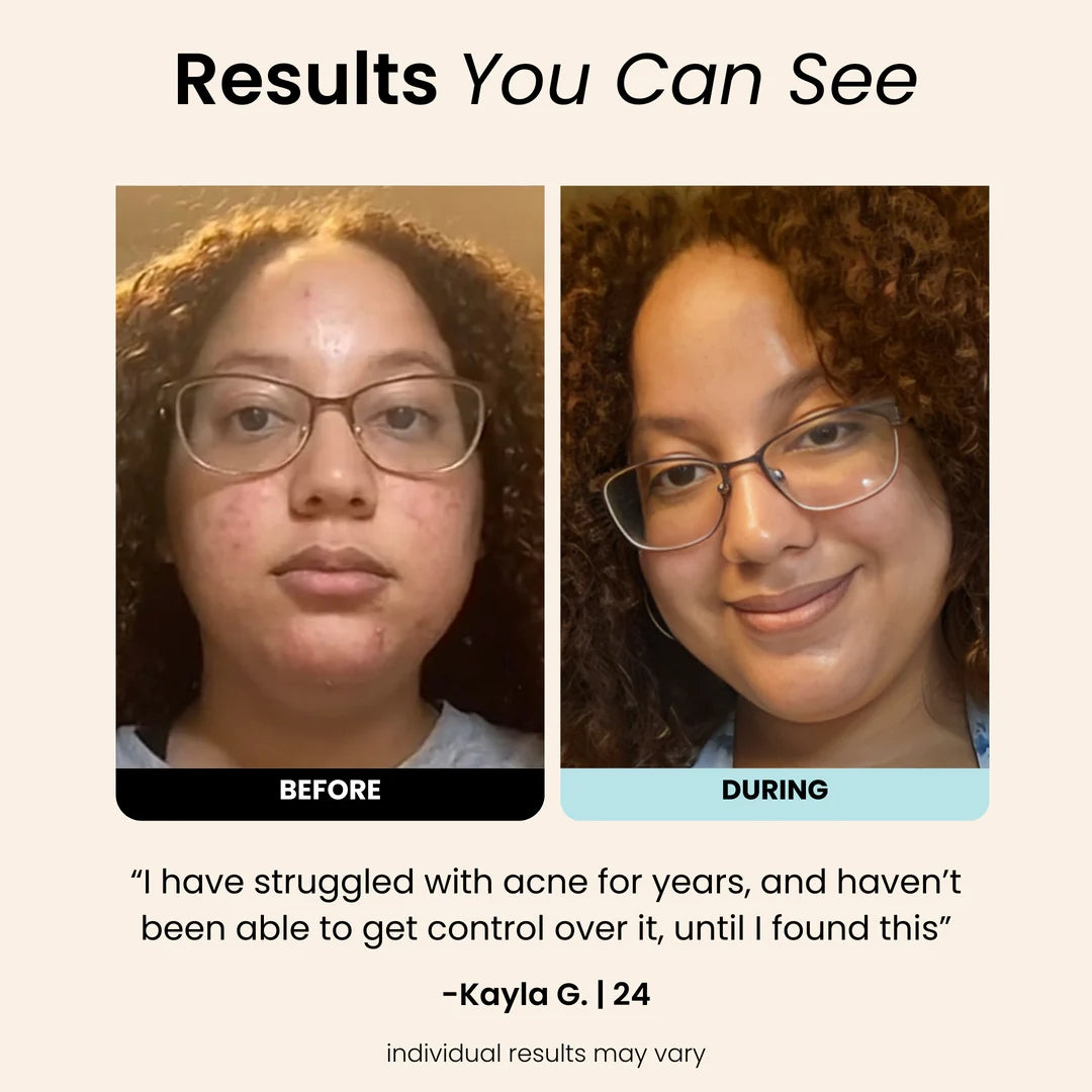 Regenmask 2.0 - Silicone Therapy Face Mask