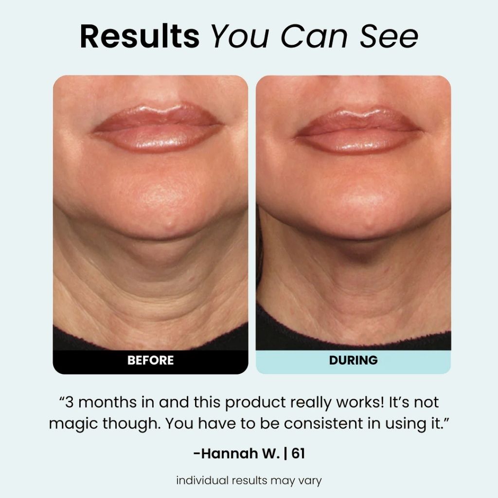 LUMIDERMIS™  - Regenmask