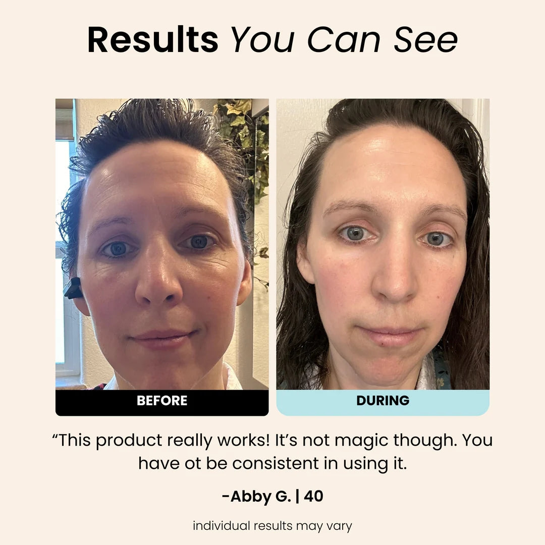 Regenmask 2.0 - Silicone Therapy Face Mask