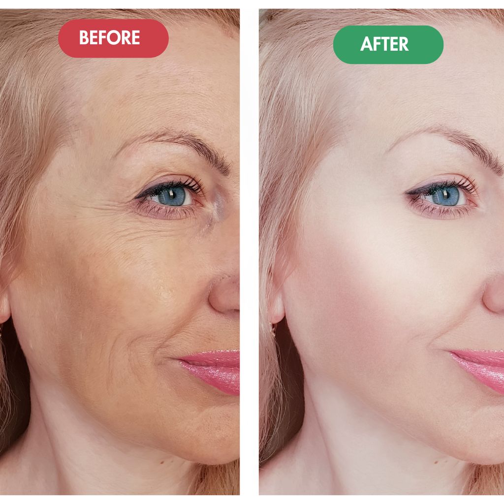 LUMIDERMIS™  - Regenmask